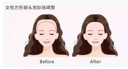 發(fā)際線粉填充和發(fā)際線筆哪個好？配合使用才最完美