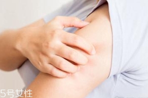 身體皮膚干燥用什么護(hù)膚品？這些身體乳拯救爆皮掉屑