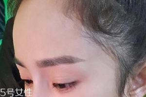 發(fā)際線高怎么治？拯救發(fā)際線攻略