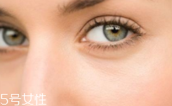 黑眼圈很重是什么原因？深扒三類黑眼圈的成因