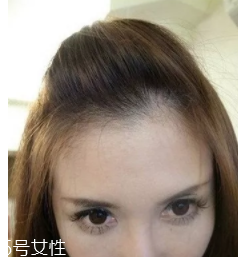 什么女孩適合不留劉海？圓臉妹子掀起劉海更適合你
