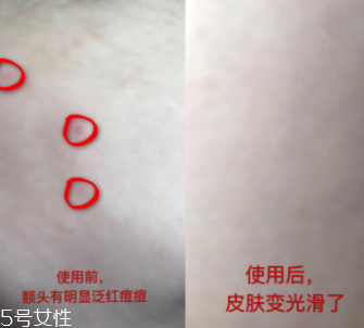 資生堂紅腰子適合什么年齡？最適合30歲以下人群