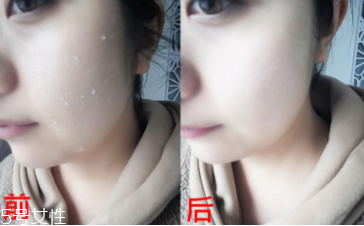 rosette去角質(zhì)凝膠怎么樣？真正的去角質(zhì)產(chǎn)品