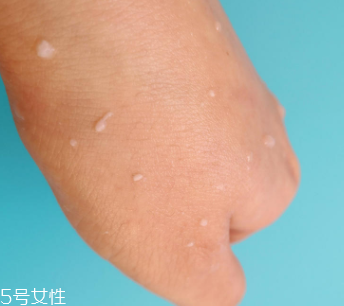rosette去角質(zhì)凝膠怎么樣？真正的去角質(zhì)產(chǎn)品