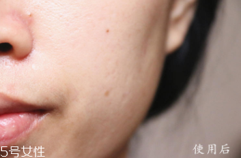 悅木之源和伊麗莎白雅頓哪個好？兩款精華大比拼