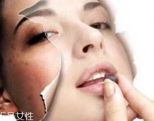 春季如何預(yù)防皮膚過敏？選擇敏感肌專用護(hù)膚品