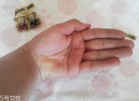 柳屋生發(fā)水有用嗎？一個月后長出新發(fā)