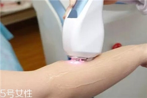 脫毛儀可以脫發(fā)際線嗎？脫了還會再長