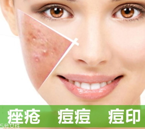 a酸是什么？a酸的功效與副作用