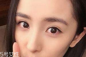 葉黃素能治療夜盲癥嗎？看什么類型的