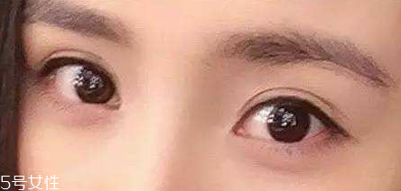葉黃素能治療夜盲癥嗎？看什么類型的