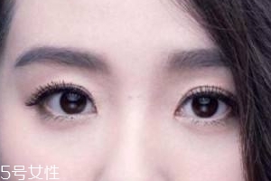 葉黃素會過敏嗎？一般不會的