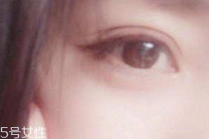 葉黃素一天吃多少毫克？按說明服用