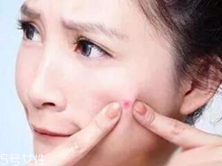 臉頰老長痘痘怎么辦 4個(gè)小技巧穩(wěn)贏