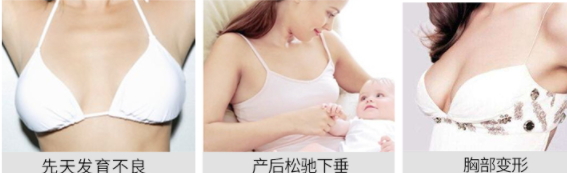 豐胸霜怎么用？豐胸霜使用手法詳解