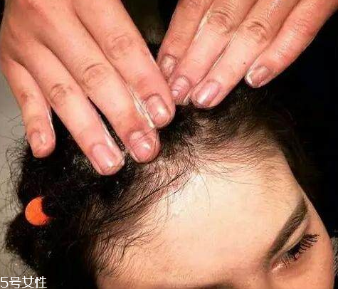 臟辮多久洗一次 臟辮是這樣養(yǎng)護的