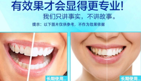 美白牙貼會反彈嗎？牙貼美白效果持續(xù)多久