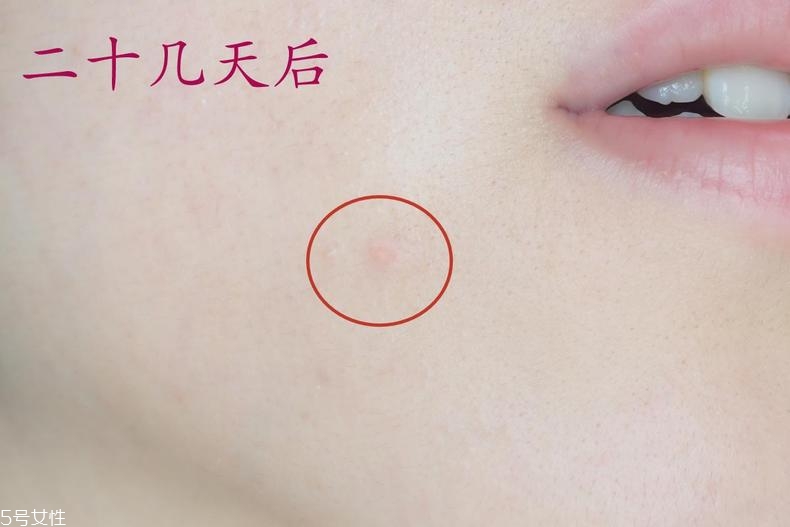 雅詩(shī)蘭黛晶透沁白防曬搖搖乳成膜快嗎？適合油痘皮嗎？