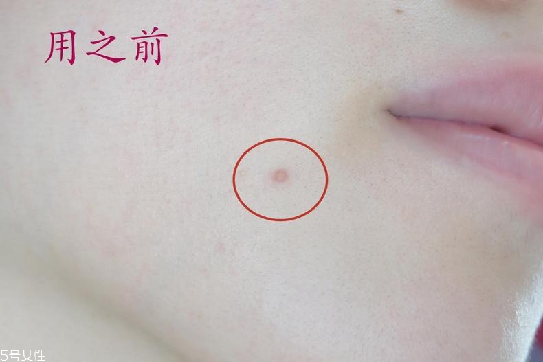 雅詩(shī)蘭黛晶透沁白防曬搖搖乳成膜快嗎？適合油痘皮嗎？