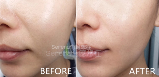 dermawand逆齡射頻注氧棒怎么用？