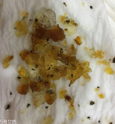 桃膠能和雞蛋一起吃嗎？桃膠配雞蛋可以嗎？