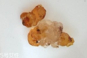 桃膠可以用開(kāi)水泡嗎？用開(kāi)水泡桃膠好嗎？