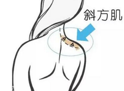 瘦肩針間隔多久打一次？打瘦肩針間隔時(shí)間