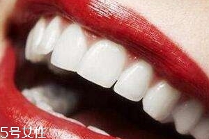 冷光美白會反彈嗎？冷光美白心得