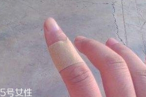 創(chuàng)可貼可以消腫嗎？創(chuàng)可貼有消腫功效嗎？