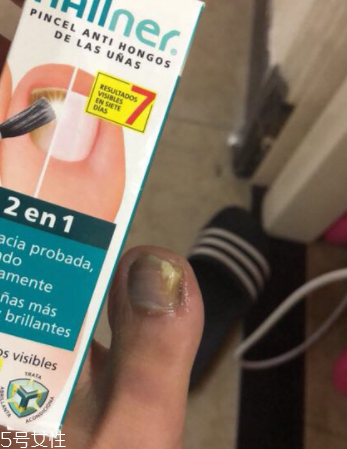 灰甲清有副作用嗎？灰甲清有哪些副作用？