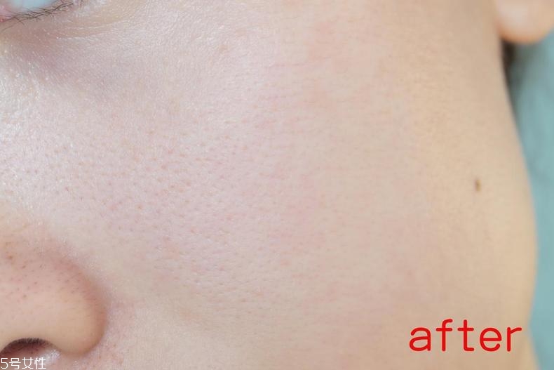 radha beauty vc精華白天能用嗎？敏感肌能用嗎？