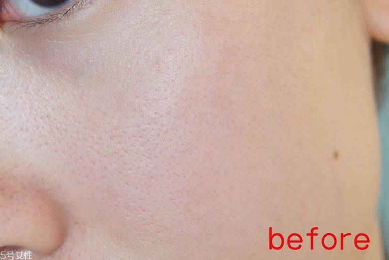 radha beauty vc精華白天能用嗎？敏感肌能用嗎？