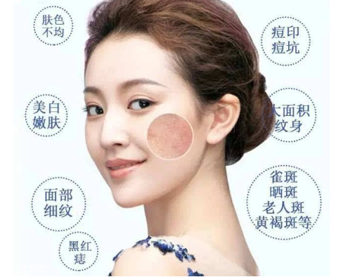 皮秒會反黑嗎 這是正?，F(xiàn)象