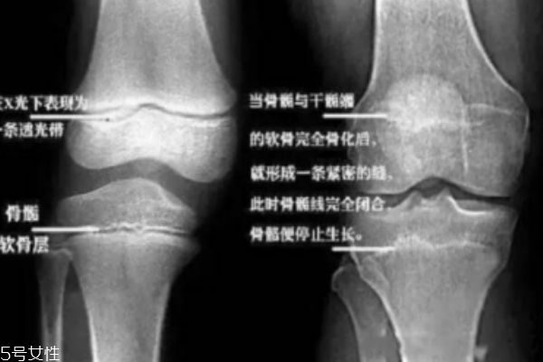成年后如何長(zhǎng)高 讓你二次長(zhǎng)高的辦法