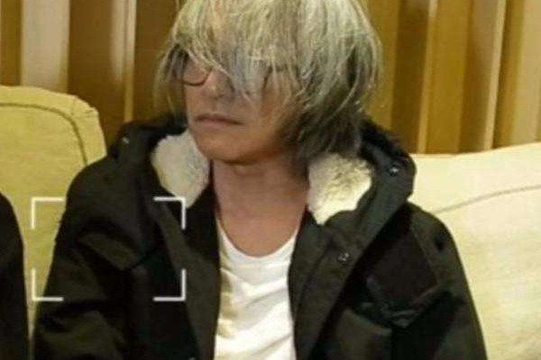 白頭發(fā)可以染色嗎 白頭發(fā)的治療