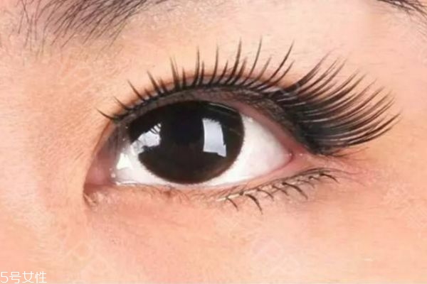 眼瞼下至術是什么 眼瞼下至術的手術原理