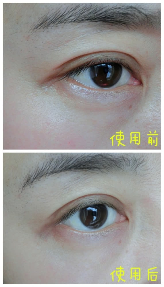 VIIcode夜間氧眼貼抗老效果怎么樣？VIIcode眼膜使用測(cè)評(píng)