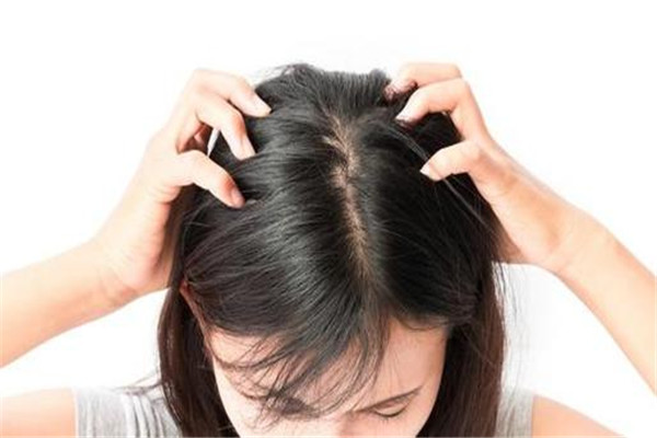 經常染頭發(fā)會掉頭發(fā)嗎 經常染頭發(fā)好不好