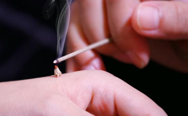 哪些人群不適合艾炙 這8類(lèi)人要慎重
