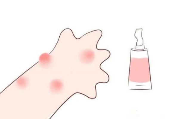孩子過敏要去醫(yī)院?jiǎn)?孩子過敏要吃什么藥