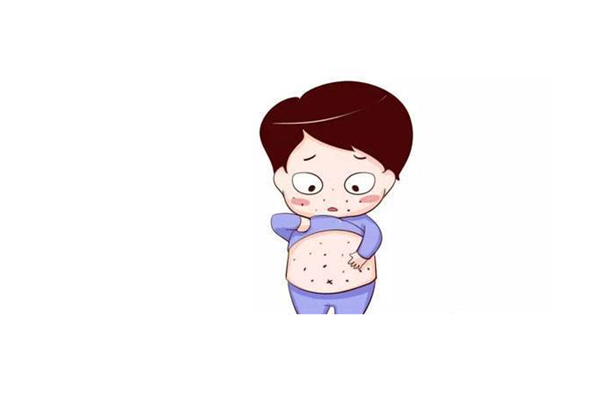小兒風(fēng)疹怎么止癢 小兒風(fēng)疹怎么護理