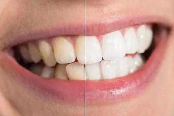 牙黃怎么變白簡(jiǎn)單方法 牙黃是什么原因?qū)е碌?>
<p class=