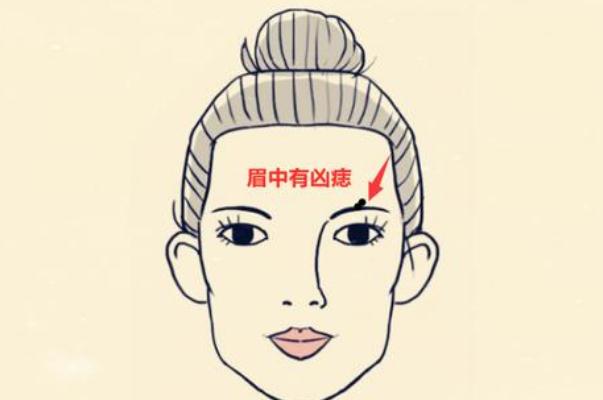 點(diǎn)痣會(huì)不會(huì)復(fù)發(fā) 點(diǎn)痣會(huì)留疤留坑嗎