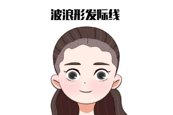 發(fā)際線后移怎么恢復 發(fā)際線后移是什么原因引起的
