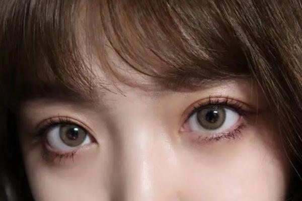 開(kāi)眼角有必要嗎 開(kāi)眼角會(huì)長(zhǎng)回去嗎