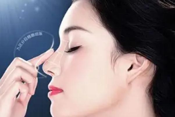 膨體隆鼻會一年比一年矮嗎 膨體隆鼻的優(yōu)點(diǎn)和缺點(diǎn)