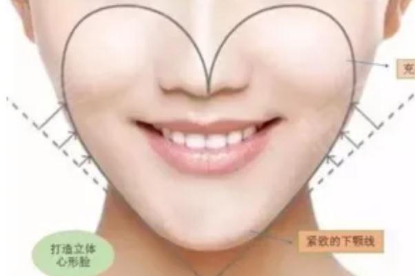 蘋(píng)果肌復(fù)位術(shù)多少錢(qián) 蘋(píng)果肌復(fù)位最好的辦法