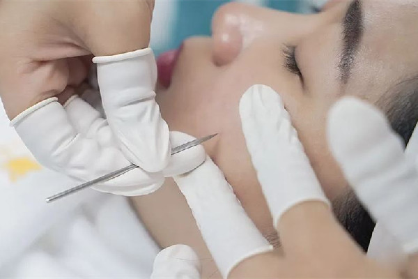 中南路夢都?巴厘女子SPA養(yǎng)生會(huì)所針清后感覺好嗎 針清祛痘后怎么護(hù)理
