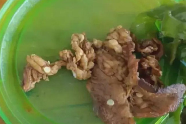 學(xué)生質(zhì)疑店家賣(mài)淋巴肉被威脅 淋巴肉吃了會(huì)怎樣