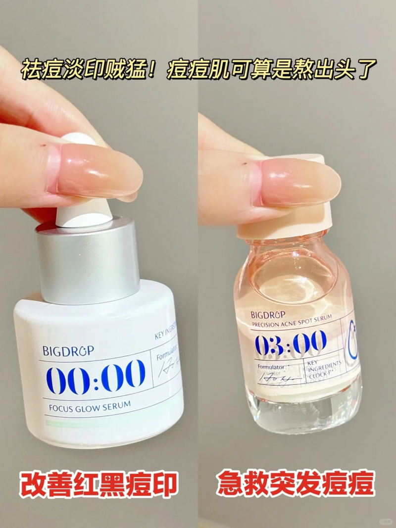 祛痘產(chǎn)品橫測：谷雨白千祛痘凝膠、大水滴與達爾膚杏仁酸，誰是祛痘王者？